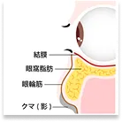 クマ・たるみの原因