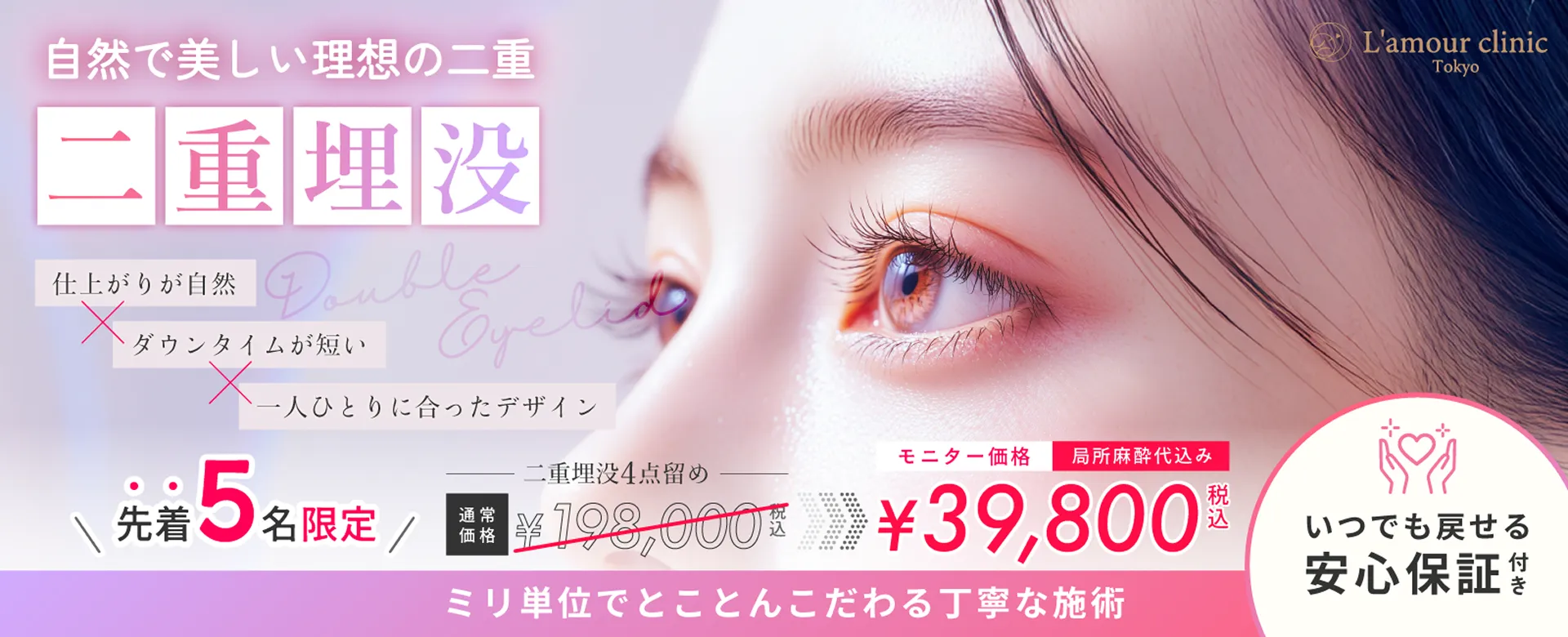 自然で美しい理想の二重 二重埋没