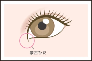 蒙古ひだがしっかりある目