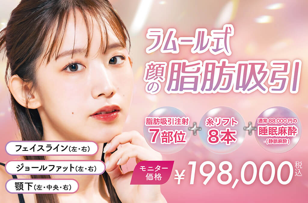 ラムール式 顔の脂肪吸引