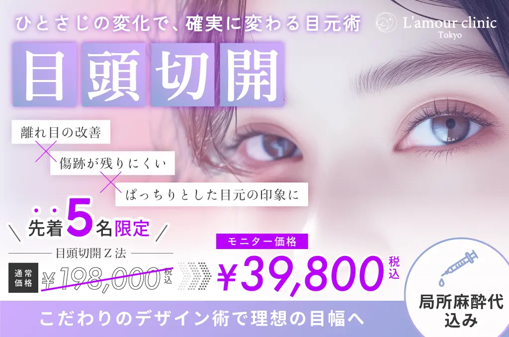 二重埋没4点キャンペーン