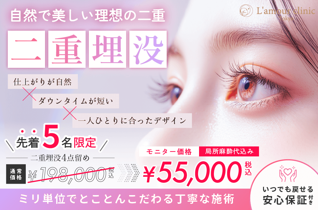 二重埋没4点キャンペーン