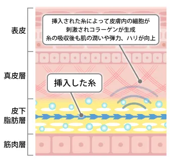 リバイタライジング効果