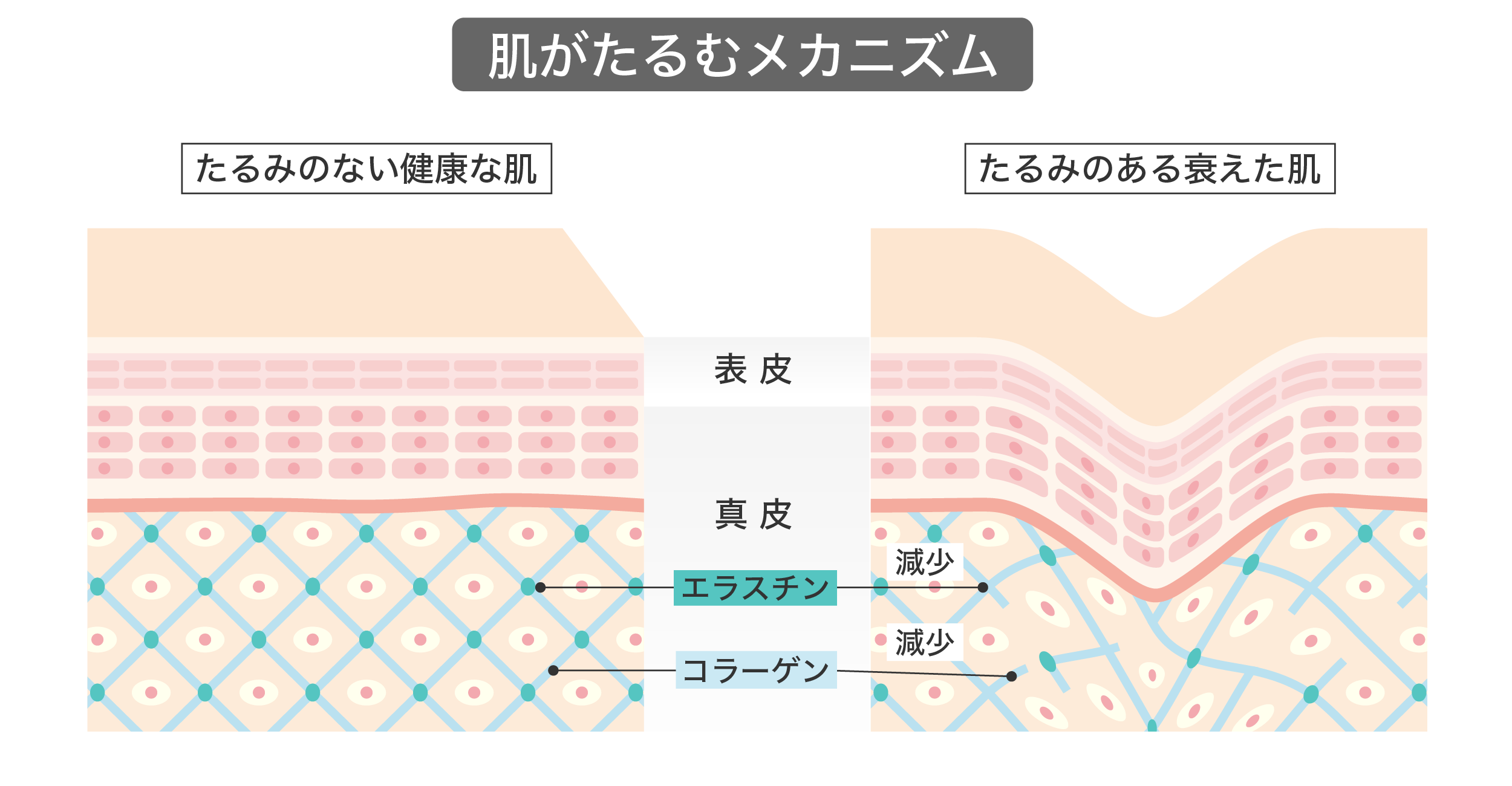 30代でほうれい線が目立つ原因や対策を解説！症例も紹介 | L’amour clinic Tokyo（ラムールクリニック東京）渋谷院