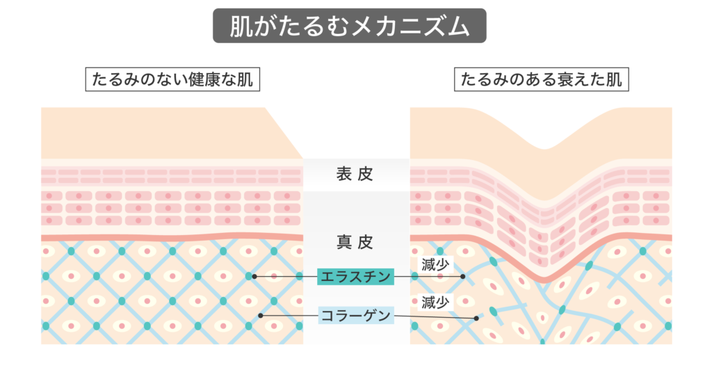 肌がたるむメカニズム