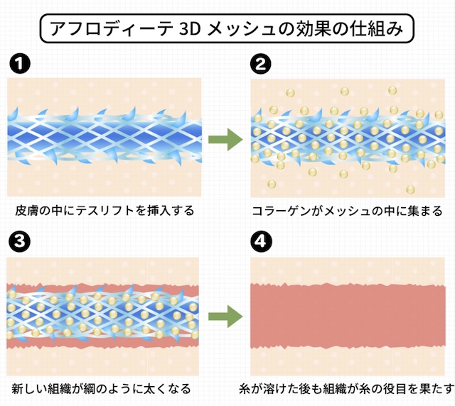 アフロディーテ3Dメッシュ