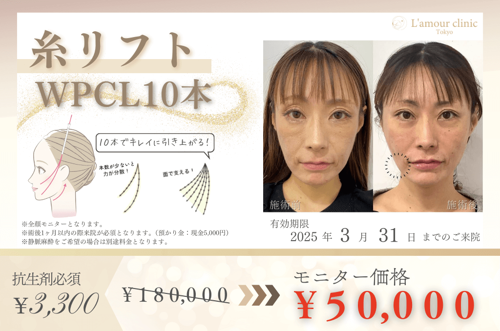 糸リフトキャンペーン