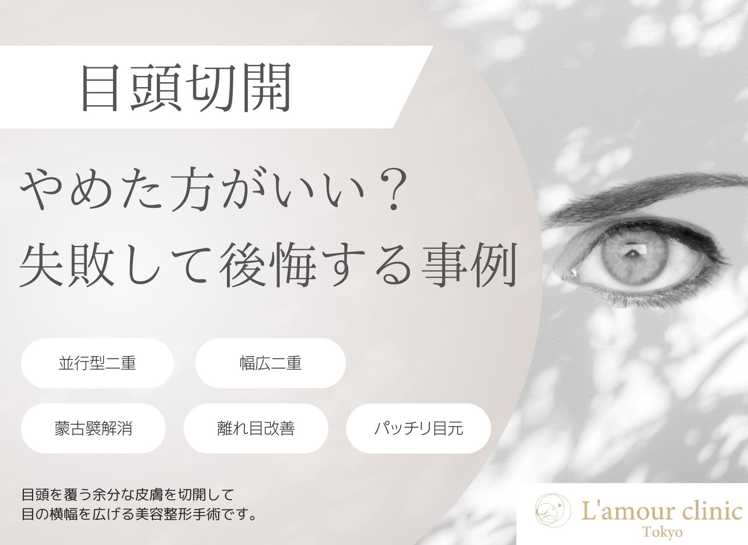 目頭切開 やめた方がいい