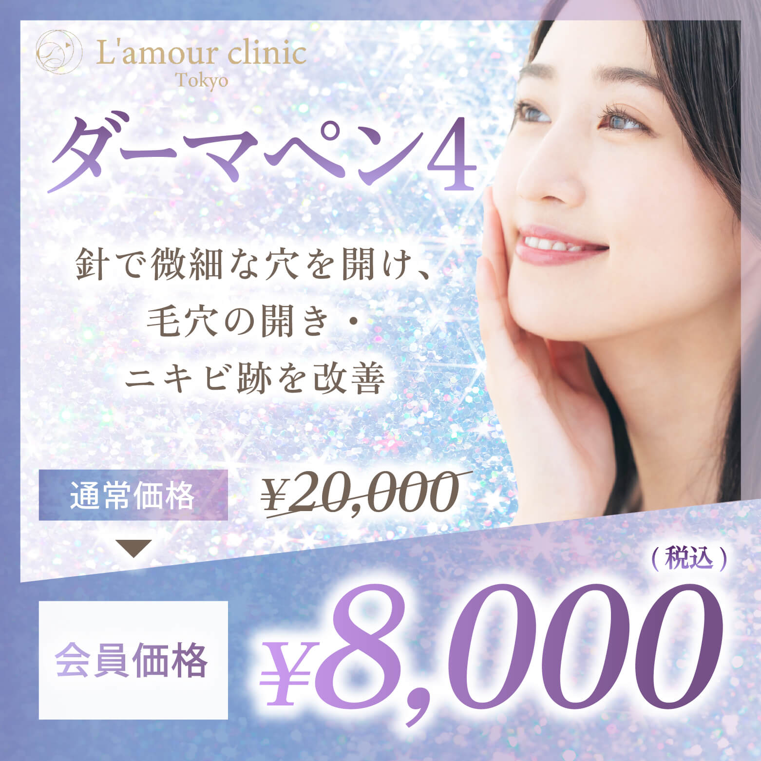 ダーマペン会員価格