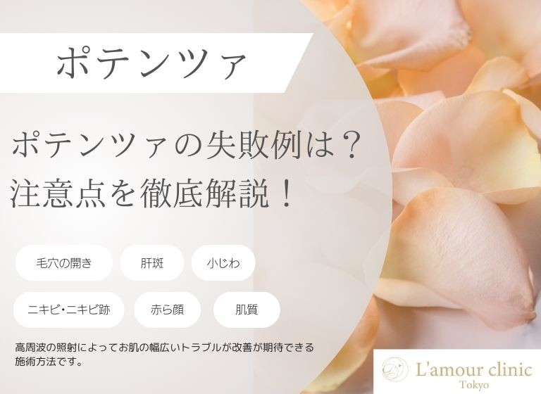 ポテンツァ 失敗例