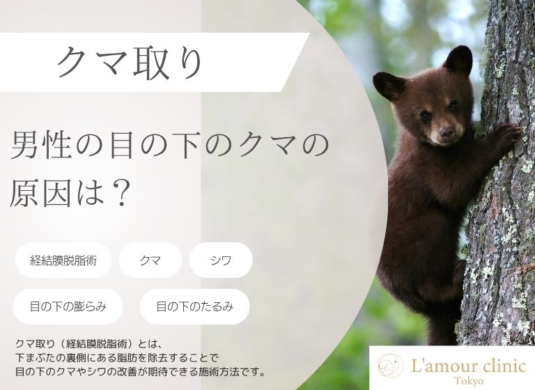 目の下 クマ 原因 男性