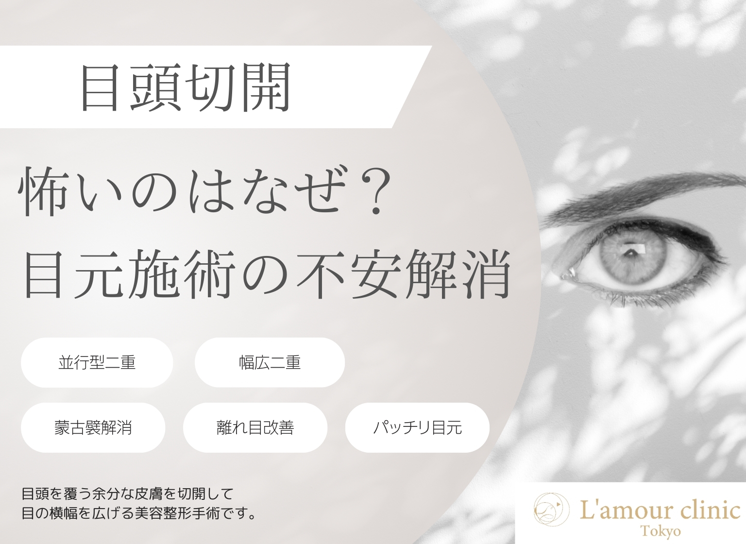 目頭切開 怖い