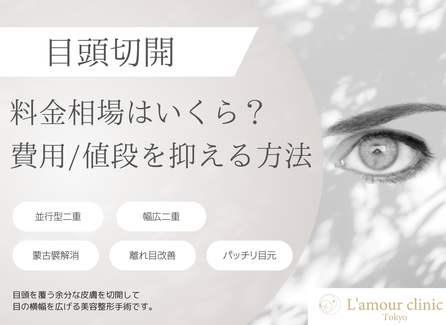 目頭切開 相場