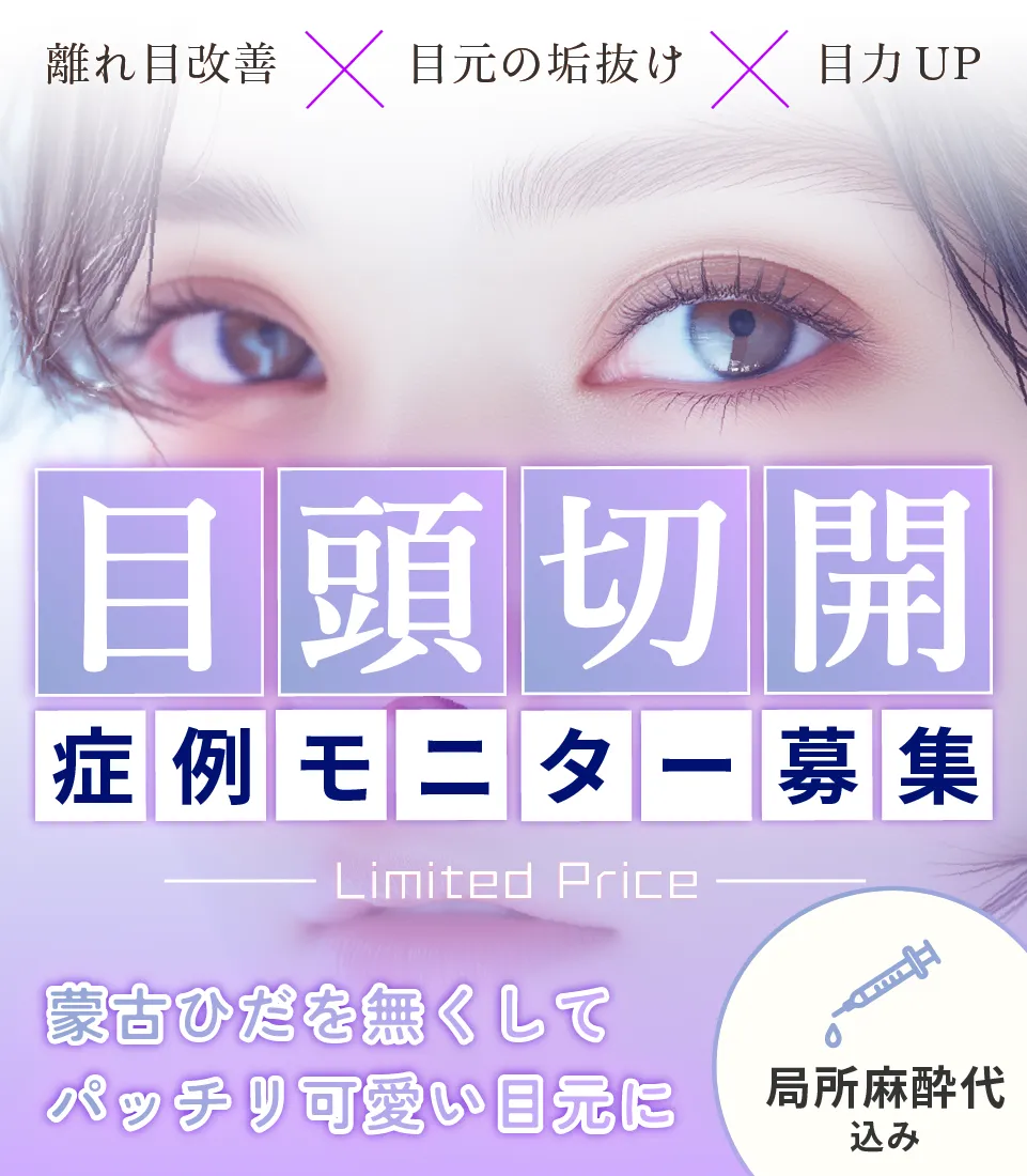 目頭切開 sp モニター バナー