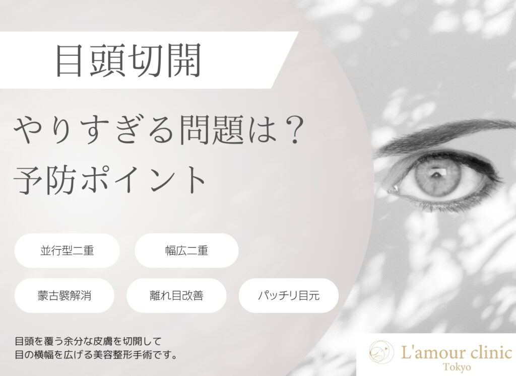 目頭切開 やりすぎ