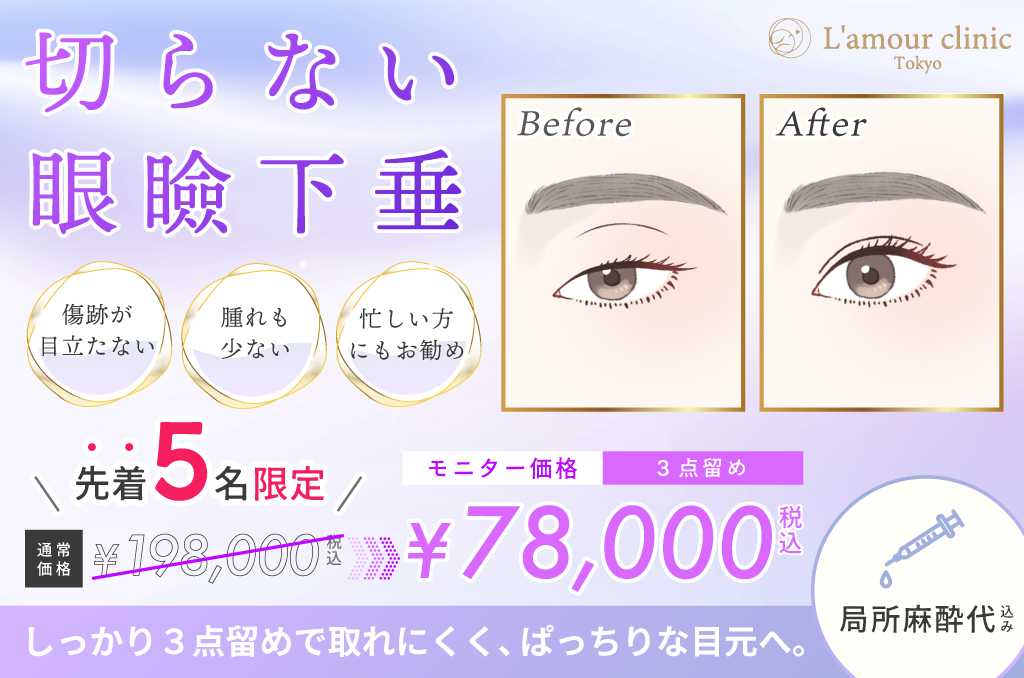 切らない眼瞼下垂_施術バナー