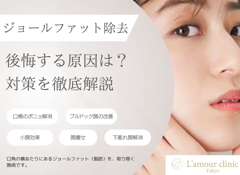 ジョールファット除去 後悔