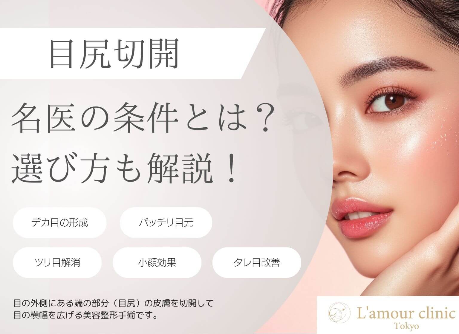 目尻切開の名医の条件