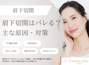 眉下切開はバレる？