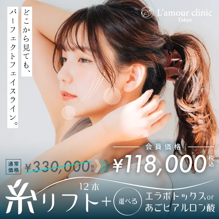 パーフェクトフェイスライン