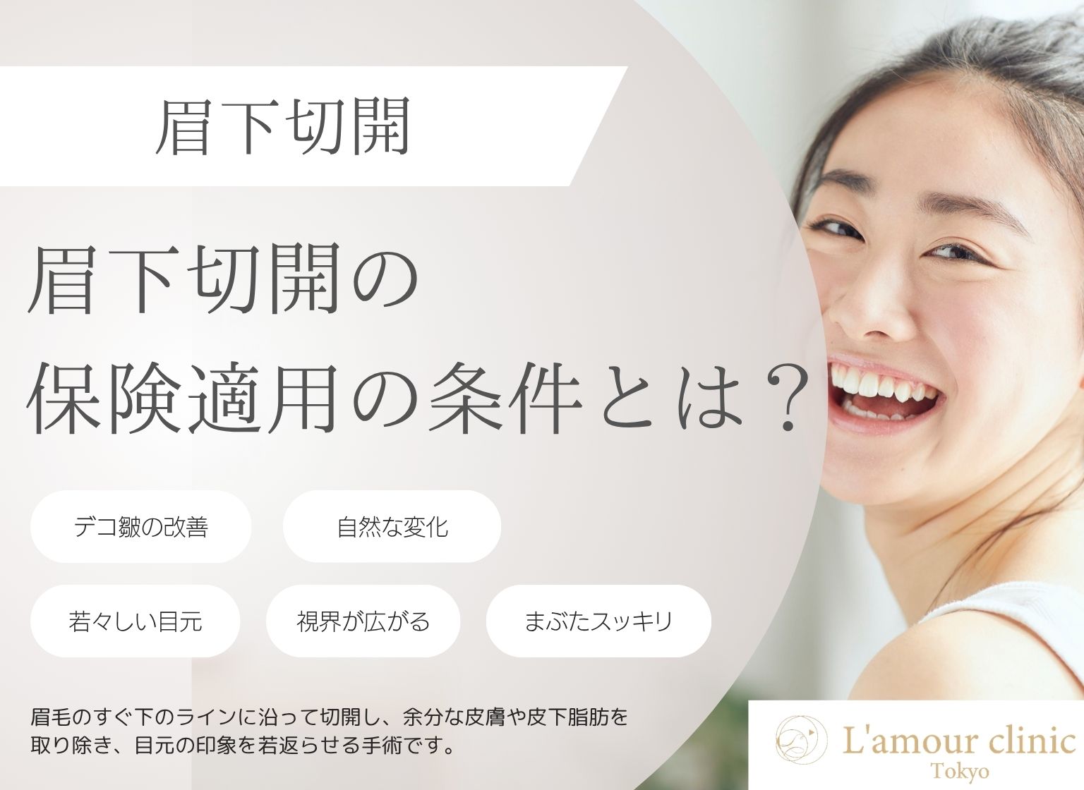 眉下切開で保険が適用される条件とは？自費との違いや費用も解説