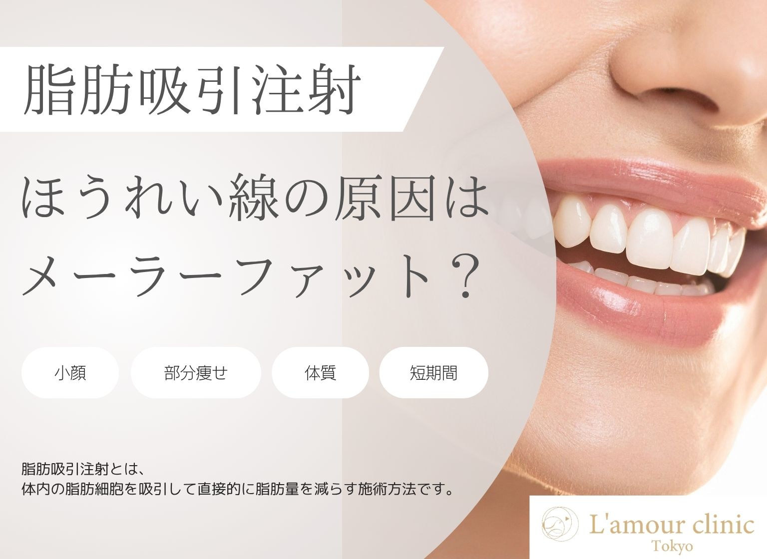 ほうれい線の原因はメーラーファット？除去の効果とリスクを徹底解説