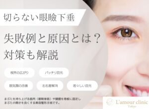 切らない眼瞼下垂の失敗例と原因|後悔しないための対策を解説