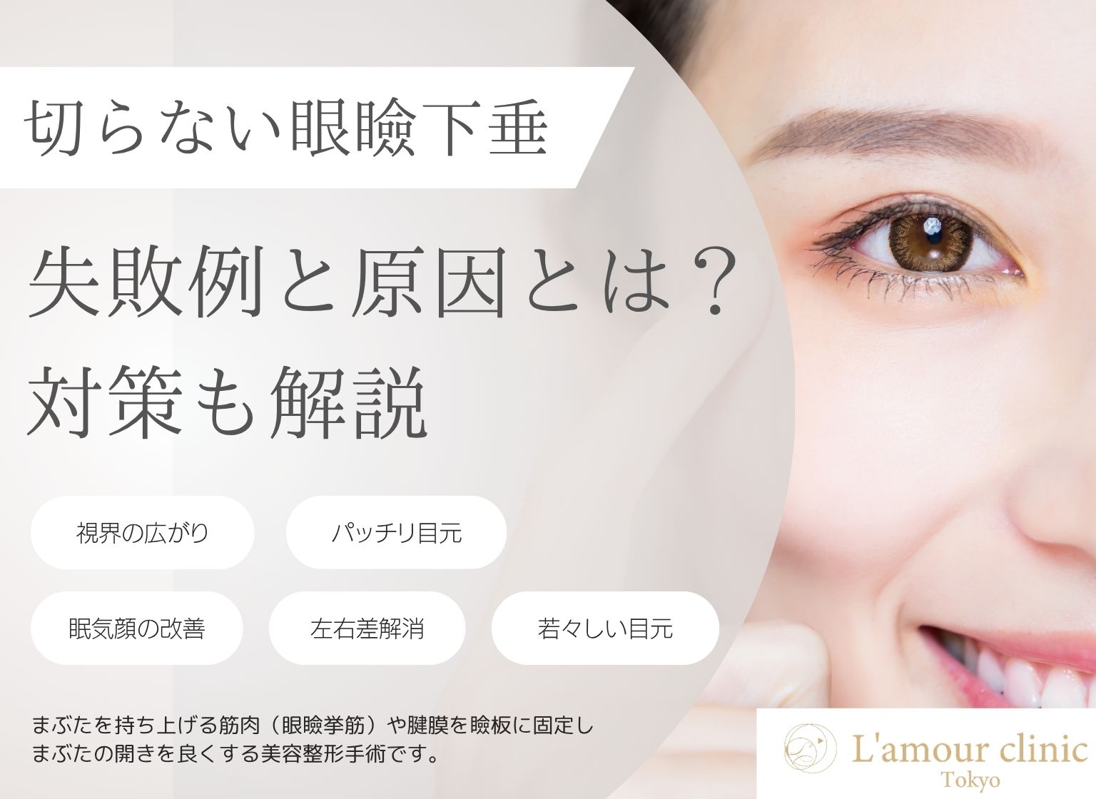 切らない眼瞼下垂の失敗例と原因｜後悔しないための対策を解説