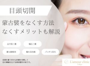蒙古襞をなくす方法｜セルフケアの限界と目頭切開に期待できる効果