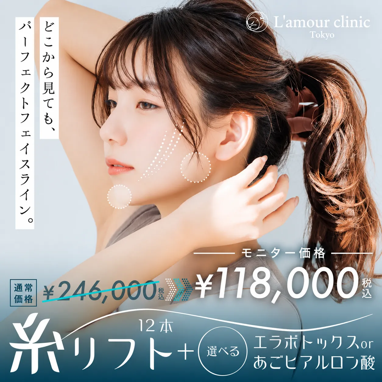 パーフェクトフェイスライン